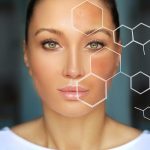 Dark spots, freckles,hyperpigmentation(melasma or chloasma)