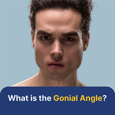 GONIAN ANGLE